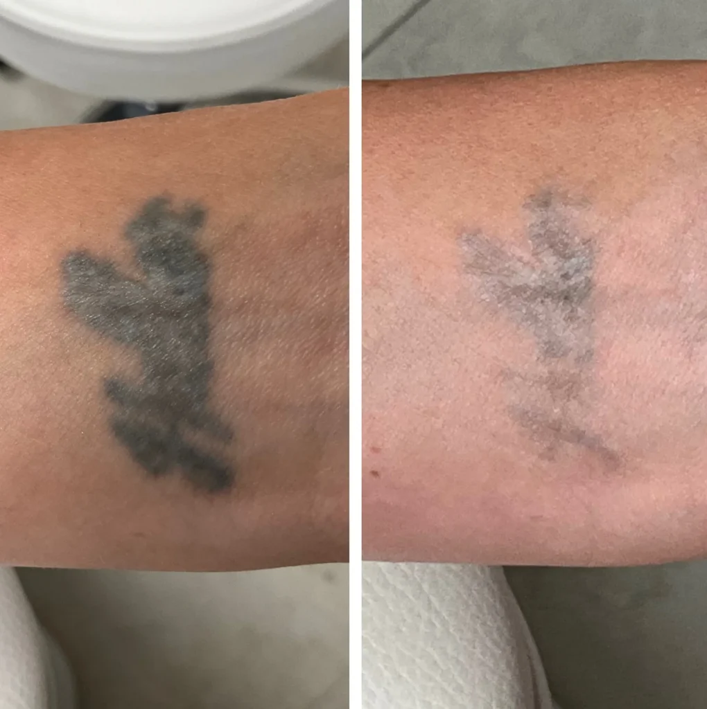 tattoo concealer that works