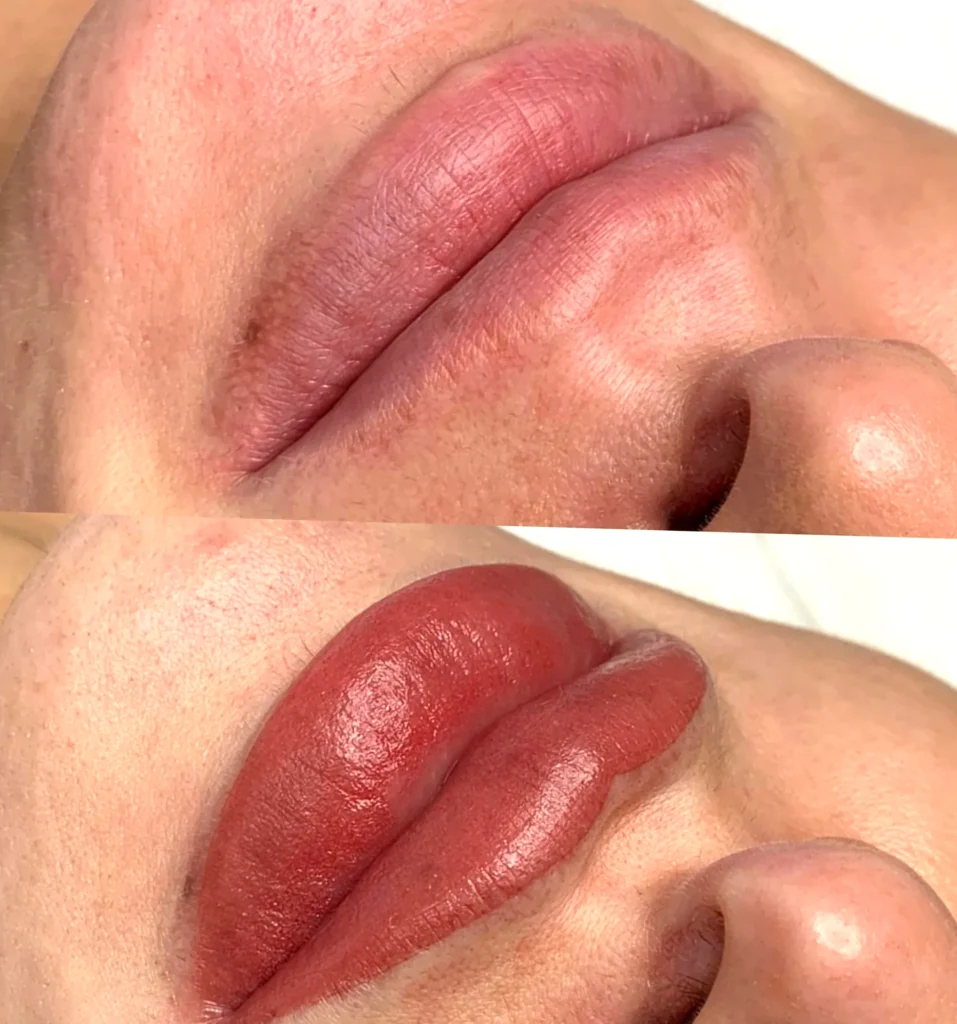 risks of unsupervised cosmetic tattooing